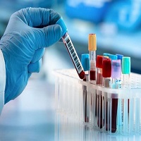 Picture of related test