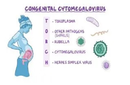 Picture of related test